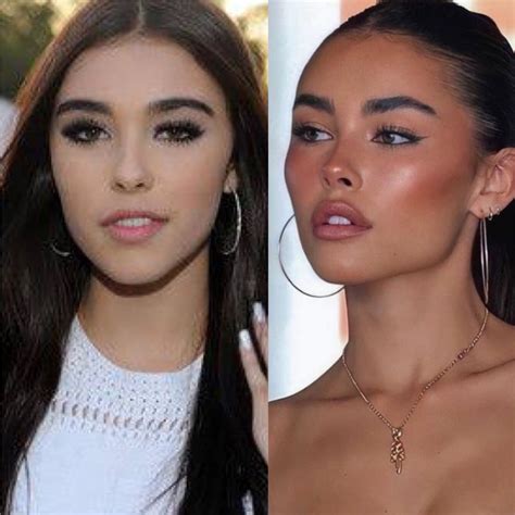 madison beer plastic sugery|Madison Beer shows “proof” she didn’t have plastic surgery after。